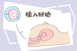做第三代试管婴儿到底痛不痛？取卵属于几级疼痛？