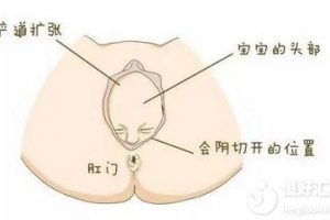 会阴切除听着都怕？做好这些让你避免切除的命运