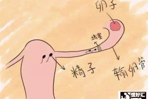 输卵管不通除了试管还有一种治疗方法可以选择