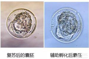 马来西亚试管婴儿医院科普：为什么胚胎冷冻多年解冻后仍可使用？