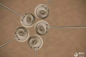 在广州做试管婴儿前，需要了解的囊胚小知识