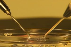 做试管婴儿可不是你想象中的那么简单，看这4点来了解了解