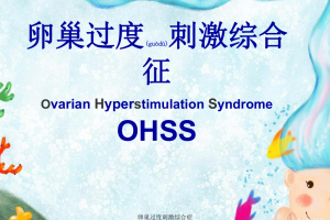 卵巢过度刺激综合征的原因是什么？哪类人比较容易得？有哪些症状？