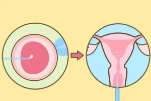 试管婴儿胚胎移植后有哪些注意事项呢？出现失眠怎么缓解？