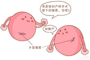 瘢痕子宫是什么？能做试管婴儿吗？
