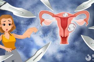 这三类女性朋友要注意子宫健康，当心子宫肌瘤盯上你！