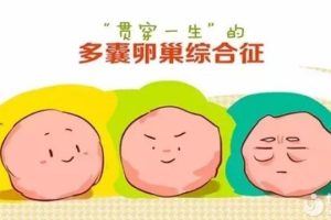 B超检查出多囊卵巢是怎么回事？
