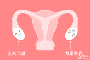 人未老，卵巢先衰，卵巢早衰应该怎么调理？