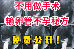 输卵管堵塞就是下焦堵了！根本不用一直用药！