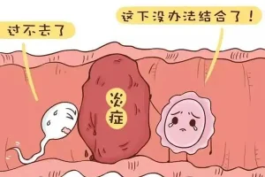 原来输卵管会堵塞还分等级，看看你是第几级！
