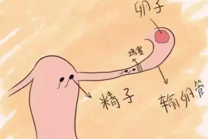 输卵管堵塞，中医的辨证分型有哪些？