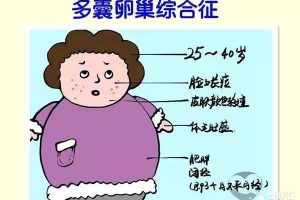 治疗多囊卵巢综合征的方法有三种，呵护女性健康，需尽早了解