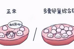 多囊卵巢拖久了会怎样？不生育就不用治?