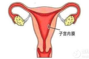 子宫内膜薄会影响生育？做试管可以吗？