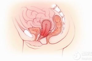 对子宫伤害很大的4个行为，女生别大意了！