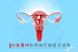 瘦子也可能患有多囊卵巢综合症？真的假的？