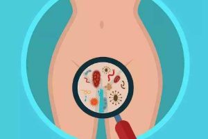 洁身自爱就代表不会患有慢性子宫内膜炎？错了！