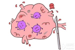 哭！这样治疗子宫内膜异位症，不能生育了！怎么办？