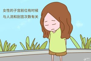 子宫前位有哪些优缺点呢？医生请回答