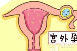宫外孕在怀孕早期要怎样才能发现？