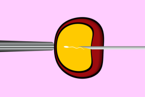 孕初期预示怀龙凤胎的8个胎梦有哪些？