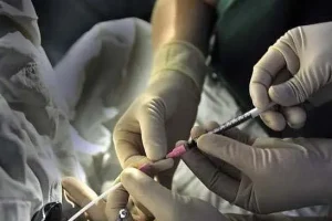 取卵头天晚上有白色分泌物正常吗？