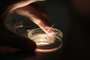 白血病患者什么时候需冷冻精子？骨髓移植后可以吗？