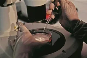 12号染色体重复1.81Mb有生下来健康宝宝的吗？