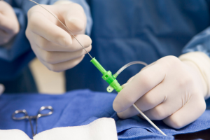 做彩超检查需要空腹吗