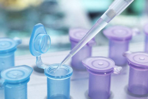 美德乐电动吸奶器买单边还是双边更方便？