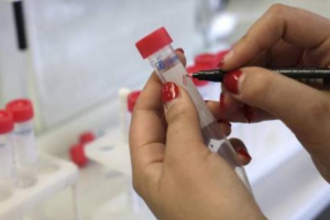 做完宫颈活检后悔了