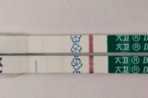 12周熟人做nt说是男孩