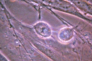 5bc的囊胚质量怎么样