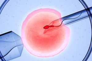 hpv筛查是怎么检查的