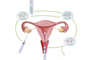 nt增厚5cm以下都没事