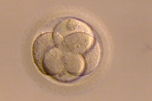 tsh促甲状腺激素偏高