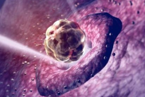 妇科白带常规检查有哪几项必须做的