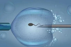 产前检查费用怎么报销