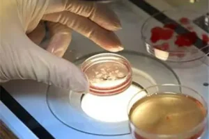 乙烯雌酚片吃了多久起作用