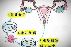 在南通大学附属医院做试管婴儿成功率高吗？