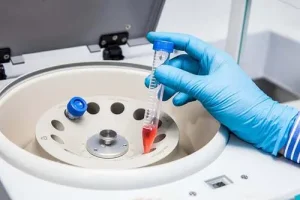 重庆第三代试管哪家医院好？重庆妇幼好还是西南医院好？