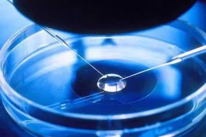 高龄排卵少会影响试管婴儿成功率吗？