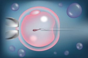 高龄不孕，做试管婴儿怎么提高成功率？