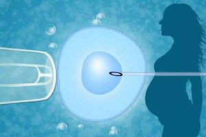 如何提高试管婴儿移植成功率