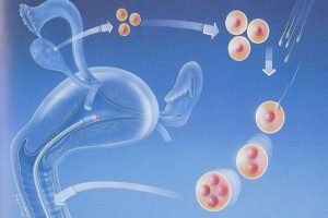 高龄女性能做试管婴儿吗?