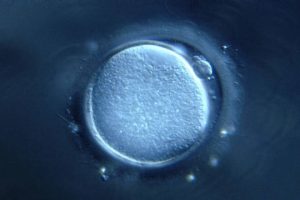 东南亚做试管婴儿哪里成功率高一些？