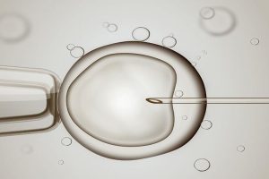 福泉市当地可以做试管婴儿吗？做试管婴儿的费用多少？