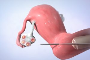 邵武能不能做试管婴儿，做一次成功率有多高？