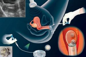 新合肥4家试管婴儿医院排名，附新合肥试管费用明细