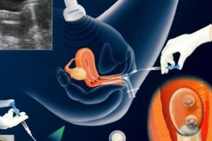 重庆试管婴儿医院新排名：哪家更好？